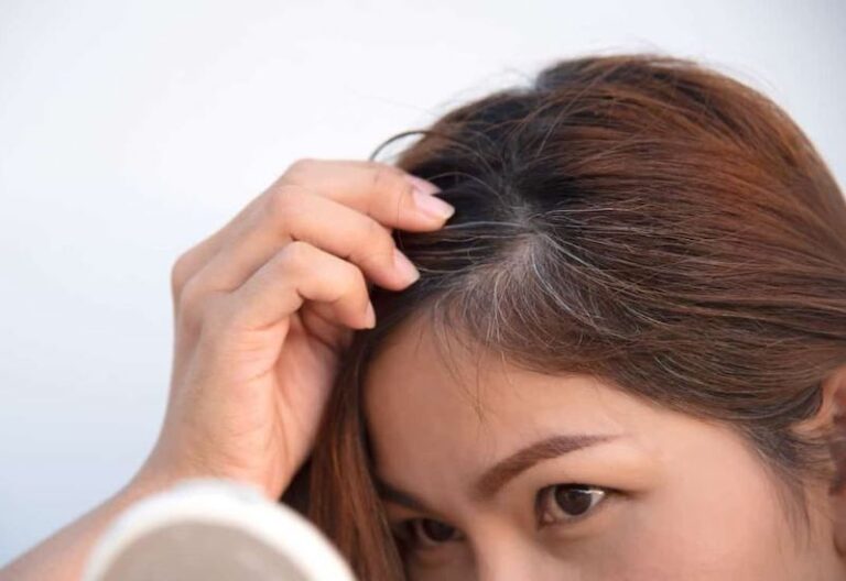 Làm gì để cải thiện tóc bạc sớm?