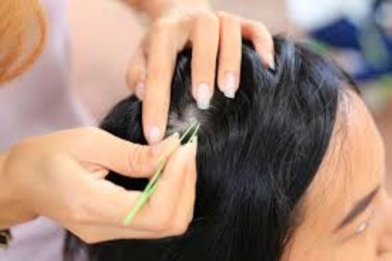 Có nên nhổ tóc bạc không?