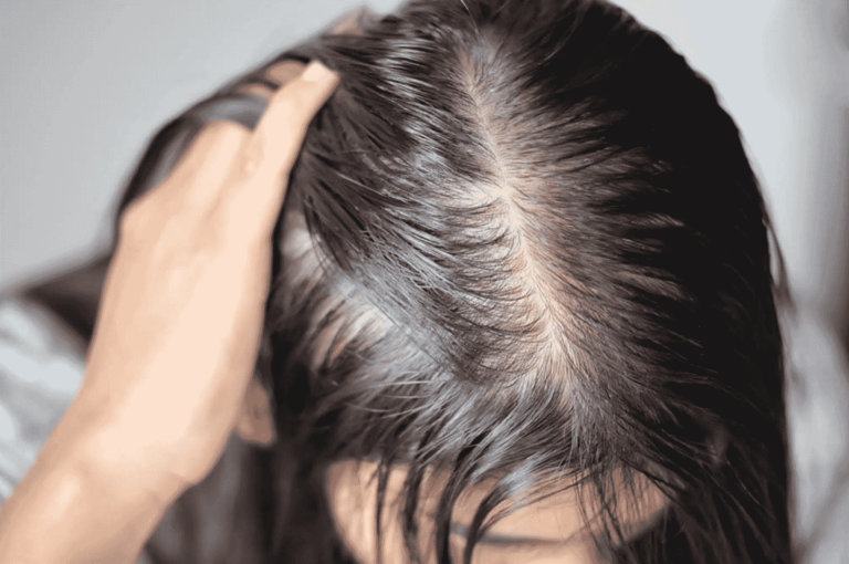 Tình trạng rụng tóc – Vấn đề chung của nhiều chị em hiện nay và 5 giải pháp hiệu quả!