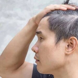 5 Nguyên Nhân Tóc Bạc Sớm Và Cách Khắc Phục Hiệu Quả
