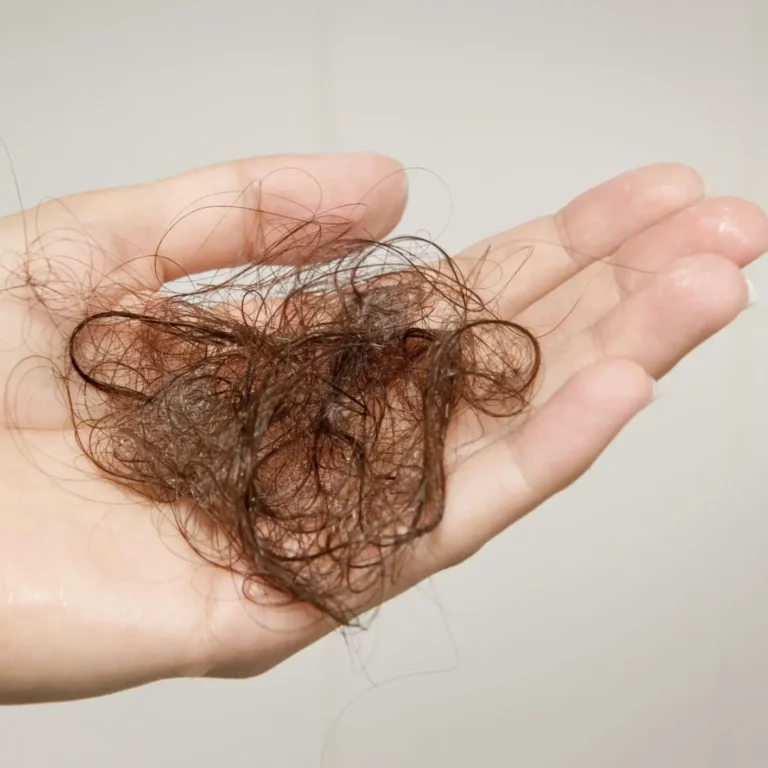 Top 7 Cách Trị Rụng Tóc Sau Sinh Hiệu Quả Tại Nhà