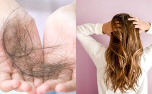 Có rất nhiều nguyên nhân dẫn đến rụng tóc 