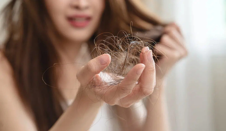 Mối liên hệ giữa Vitamin D thiếu hụt và rụng tóc