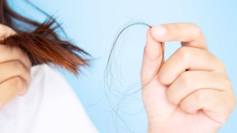 Tóc yếu và rụng nhiều trong mùa thiếu nắng