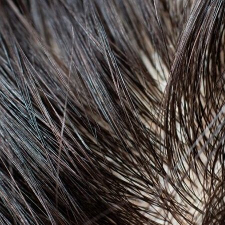 Nguyen Nhan Gay Ra Gau Ma Ban Nen Biet De Dieu Tri Triet De 10 800x450